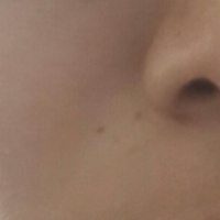 脸部肤色暗黄，有什么精油配方可以改善？