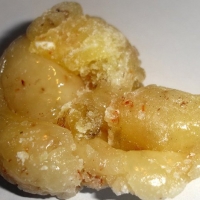 [芳疗实证]榄香脂精油功效作用与使用